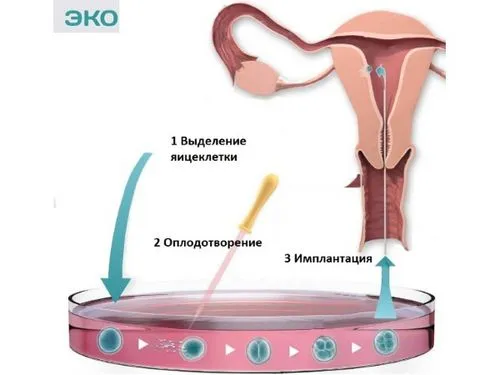 як лікувати застій жовчі при вагітності