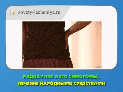 як лікувати радикуліт лопухом