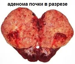 симптом