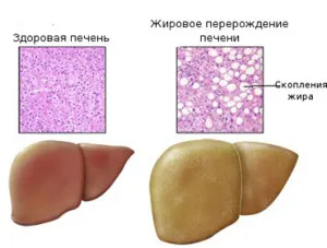 біосканер біорс