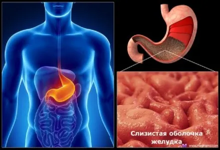 як вилікувати зернистий гастрит