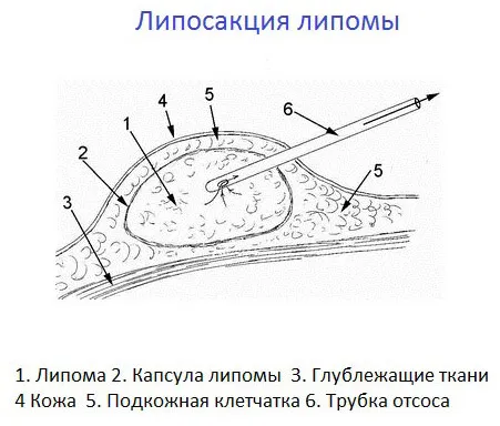 причини виникнення