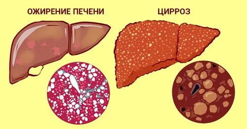 чи можна лікувати печінку травами