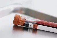 як лікувати анемію кінцівок
