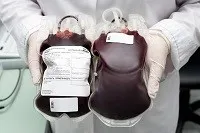 як лікувати анемію кінцівок