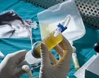 як лікувати анемію кінцівок