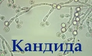 баланопостит що це і як лікувати