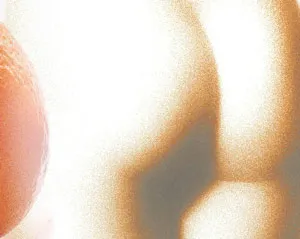 лікування