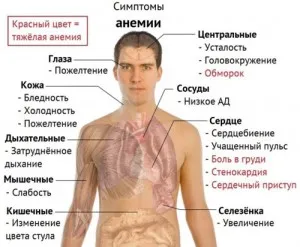 як лікувати вроджену анемію