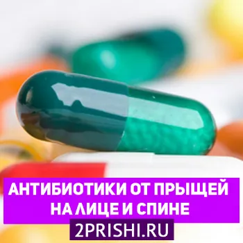 як лікувати прищі антибіотиками