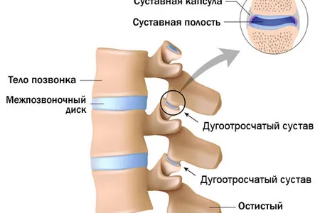 артроз хребта дугоподібний остеоартроз реберно хребетних суглобів грудного відділу симптоми і лікування