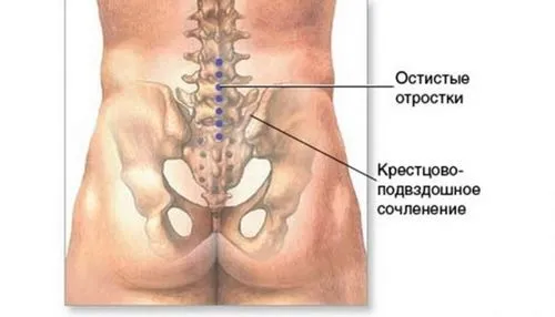 як лікувати артроз таза