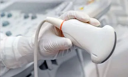 Ecografie Doppler a vaselor de cap și gât, ceea ce arată că este, prețul (a) Ecografie Doppler a vaselor de cap și gât, indicând faptul că acesta este prețul