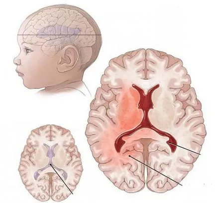 ecografie cerebrală pentru copii să facă, care arată (creierul) ecografie cerebrală pentru copii să facă, care arată