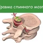 як лікувати спину якщо вона болить