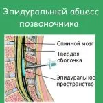 як лікувати спину якщо вона болить