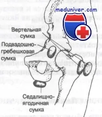 діагностика бурситу тазостегнового суглоба