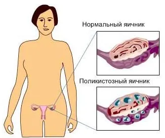 здоровий живіт