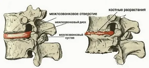 вправи