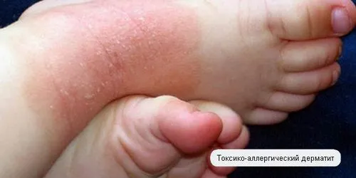 настої