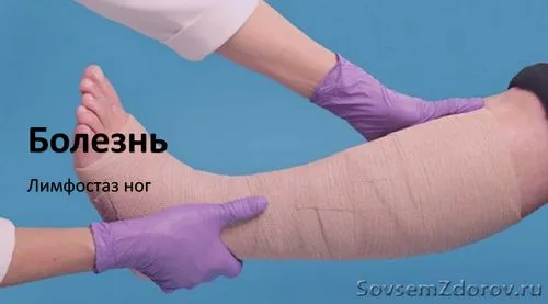 Хвороба лімфостаз ніг - блог хвороба лімфостаз ніг нижніх кінцівок захворювання