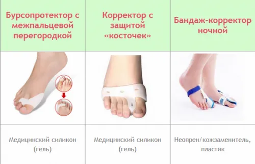 як лікувати бурсит великого пальця стопи