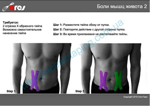 як лікувати розрив м'язів живота
