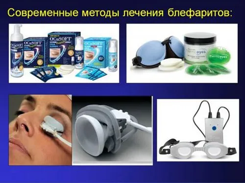 як лікувати хронічний блефарит