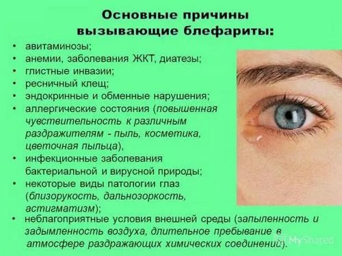 як лікувати хронічний блефарит