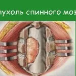 як лікувати біль спини
