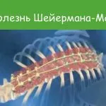 як лікувати біль спини