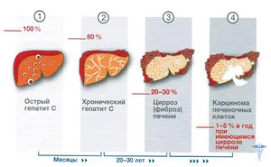 гепатит носійство носій це значить