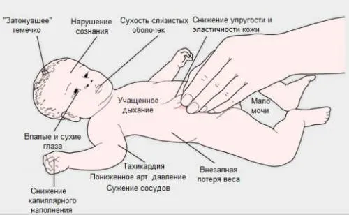 як лікувати понос дітям