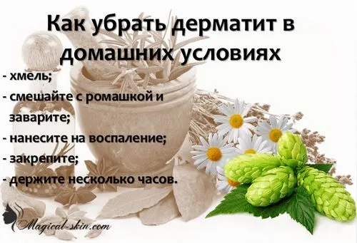 дерматит нога варикозний нижнякінцівку лікування фото мазь домашнє умова