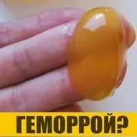 геморой 2 ступеня