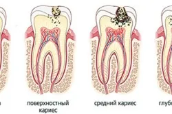 дантист будинку