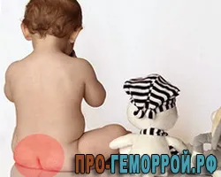 геморой у дітей