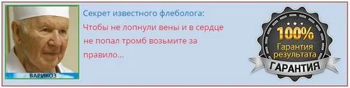 як лікувати варикоз за допомогою йоги