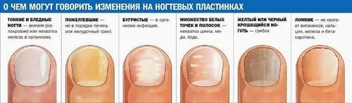 вилікувати грибок нігтів швидко