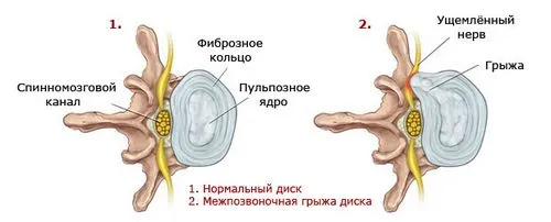 грижа шийного відділу