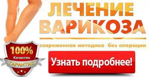 як лікувати варикоз за допомогою йоги