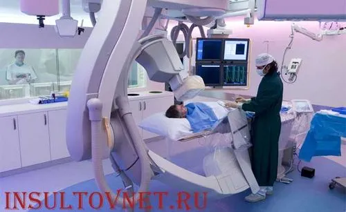 як лікувати спинальний інсульт