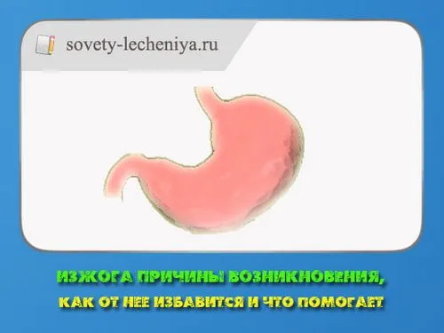 як лікувати хронічну печію
