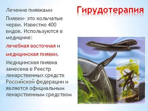 як лікувати тиск п'явками