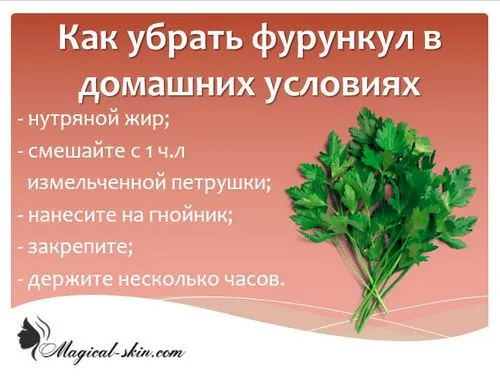 Гнійний фурункул: лікування гнійний фурункул лікування великий фото