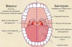 здорове горло