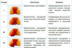 як вилікувати геморой свічки