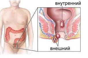 кишечник