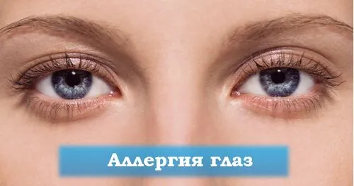 як лікувати шкірну алергію народними засобами