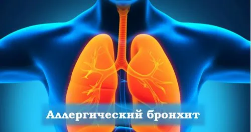 як лікувати шкірну алергію народними засобами
